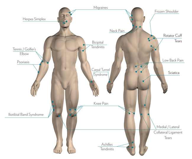 Therapy Applications Therapy Applications